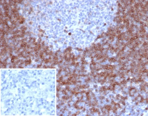 Recombinant IgD (Immunoglobulin Delta Heavy Chain) (B-Cell Marker) Antibody