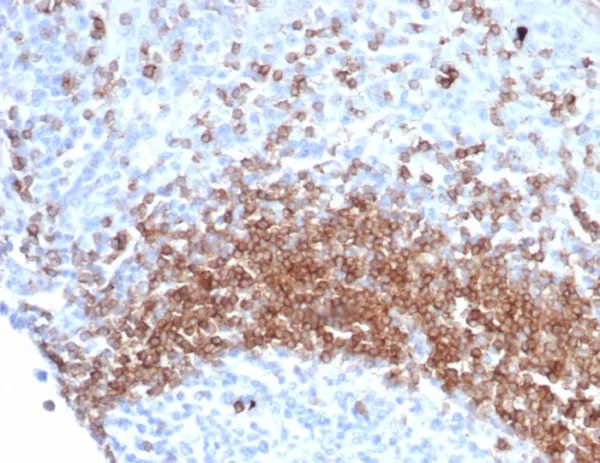 Recombinant IgD (Immunoglobulin Delta Heavy Chain) (B-Cell Marker) Antibody - Image 2