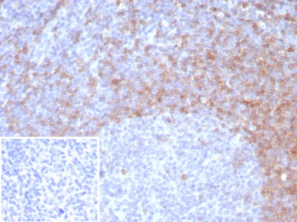 Recombinant IgD (Immunoglobulin Delta Heavy Chain) (B-Cell Marker) Antibody