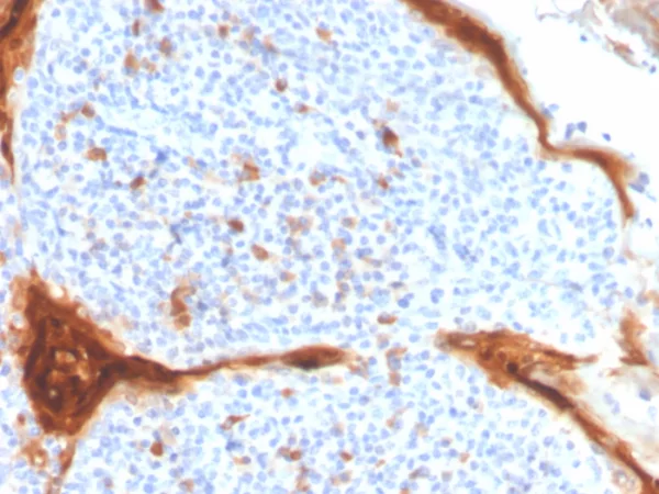 IL1RN / IL-1RN / IL1RA (Interleukin-1RA) Antibody - Image 2