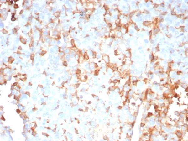 Formalin-fixed, paraffin-embedded human adrenal gland stained with Purified Interleukin-2 (IL-2) Mouse Monoclonal Antibody (IL2/9007). HIER: Tris/EDTA, pH9.0, 45min. 2°C: HRP-polymer, 30min. DAB, 5min.