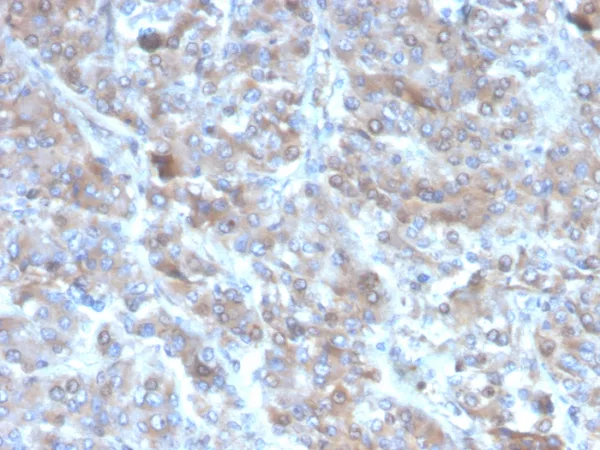 Formalin-fixed, paraffin-embedded human adrenal gland stained with Interleukin-2 (IL-2) Mouse Monoclonal Antibody (IL2/4985). HIER: Tris/EDTA, pH9.0, 45min. 2°C: HRP-polymer, 30min. DAB, 5min.