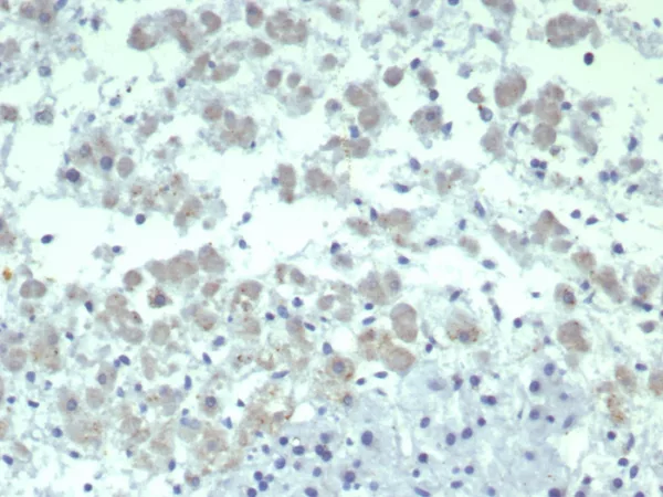 Formalin-fixed, paraffin-embedded human adrenal gland stained with Interleukin-2 (IL-2) Mouse Monoclonal Antibody (IL2/4986). HIER: Tris/EDTA, pH9.0, 45min. 2°C: HRP-polymer, 30min. DAB, 5min.