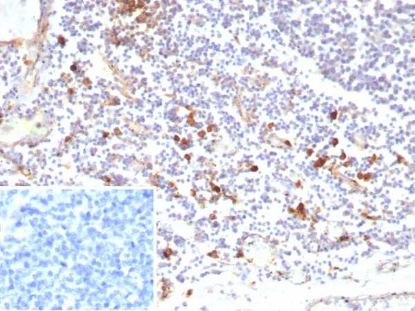 Formalin-fixed, paraffin-embedded human tonsil stained with IL3RA / CD123 Recombinant Mouse Monoclonal Antibody (rIL3RA/9212). Inset: PBS instead of primary antibody; secondary only negative control.