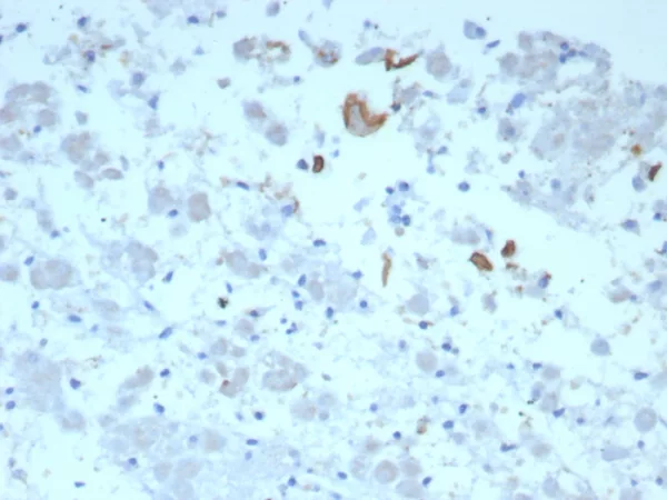 Formalin-fixed, paraffin-embedded human adrenal gland stained with IL-6 Mouse Monoclonal Antibody (IL6/8713). HIER: Tris/EDTA, pH9.0, 45min. 2°C: HRP-polymer, 30min. DAB, 5min.