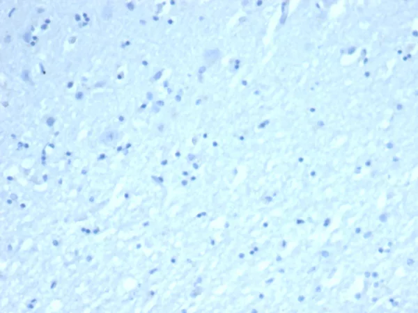 IHC analysis of formalin-fixed, paraffin-embedded human brain.  Negative tissue control using INHA/8872R at 2ug/ml in PBS for 30min RT.  HIER: Tris/EDTA, pH9.0, 45min. 2°C: HRP-polymer, 30min. DAB, 5min.