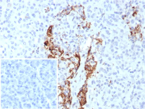 Formalin-fixed, paraffin-embedded human pancreas stained with Insulin Recombinant Mouse Monoclonal Antibody (rIRDN/8546). Inset: PBS instead of primary antibody; secondary only negative control.