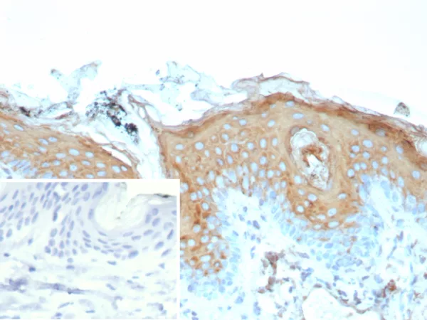 Formalin-fixed, paraffin-embedded human skin stained with Involucrin Mouse Recombinant Monoclonal Antibody (rIVRN/9323). Inset: PBS instead of primary antibody; secondary only negative control.