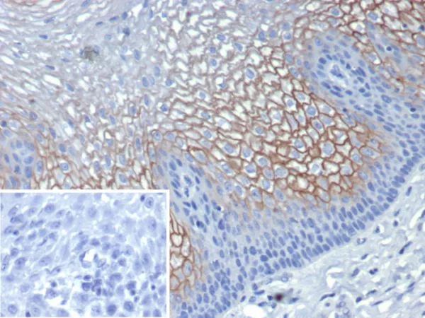 Formalin-fixed, paraffin-embedded human esophagus stained with Suprabasin (SBSN) Mouse Monoclonal Antibody (SBSN/7961). HIER: Tris/EDTA, pH9.0, 45min. 2°C: HRP-polymer, 30min. DAB, 5min.