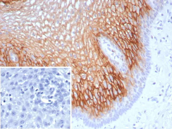 Formalin-fixed, paraffin-embedded human esophagus stained with Suprabasin (SBSN) Mouse Monoclonal Antibody (SBSN/7963). Inset: PBS instead of primary antibody; secondary only negative control.