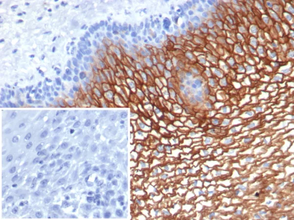 Formalin-fixed, paraffin-embedded human esophagus stained with Suprabasin (SBSN) Mouse Monoclonal Antibody (SBSN/7964). Inset: PBS instead of primary antibody; secondary only negative control.