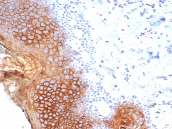 Formalin-fixed, paraffin-embedded human esophagus stained with Suprabasin (SBSN) Mouse Monoclonal Antibody (SBSN/7965). HIER: Tris/EDTA, pH9.0, 45min. 2°C: HRP-polymer, 30min. DAB, 5min.