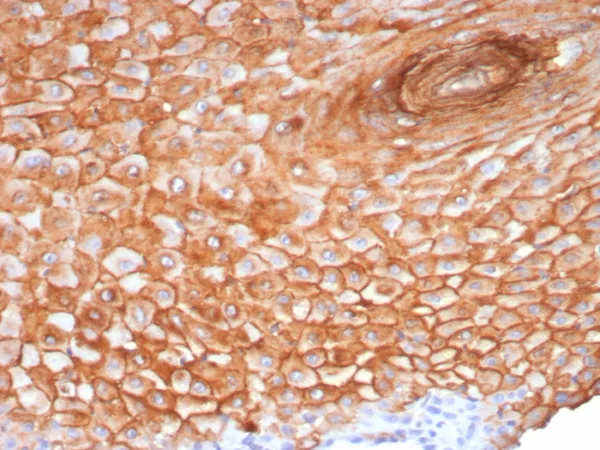 Formalin-fixed, paraffin-embedded human skin stained with Suprabasin (SBSN) Mouse Monoclonal Antibody (SBSN/7965). HIER: Tris/EDTA, pH9.0, 45min. 2°C: HRP-polymer, 30min. DAB, 5min.