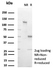 SDS-PAGE Analysis of Purified GIRK2 Mouse Monoclonal Antibody (KCNJ6/7557). Confirmation of Purity and Integrity of Antibody.