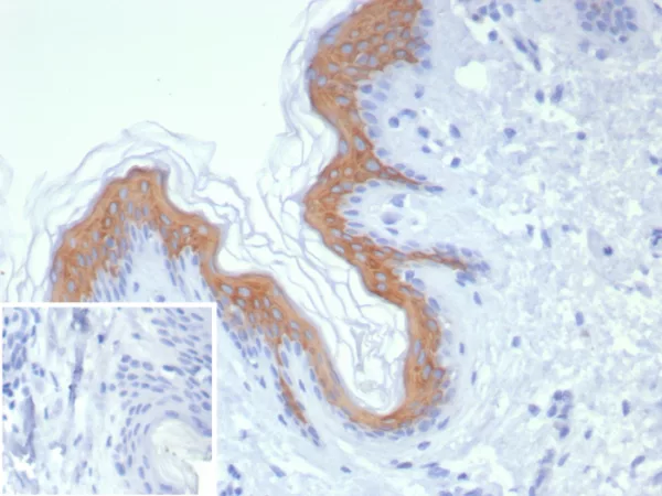 Formalin-fixed, paraffin-embedded human skin stained with Cytokeratin 1 Recombinant Rabbit Monoclonal Antibody (KRT1/8342R). Inset: PBS instead of primary antibody; secondary only negative control.