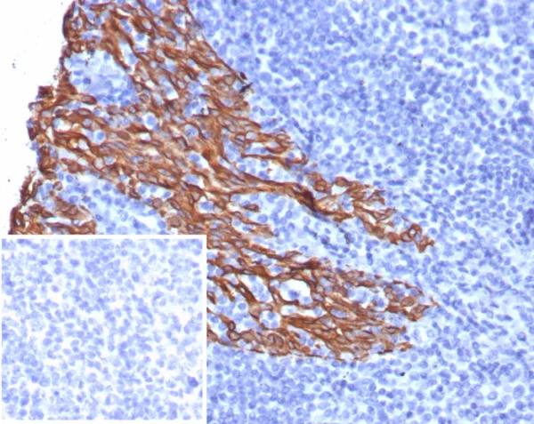 Formalin-fixed, paraffin-embedded human tonsil stained with Cytokeratin 5 Recombinant Mouse Monoclonal Antibody (rKRT5/6969). Inset: PBS instead of primary antibody; secondary only negative control.