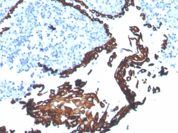 Recombinant Cytokeratin 5 (KRT5) (Basal, Myoepithelial & Mesothelial Cell Marker) Antibody