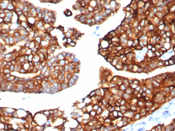 Recombinant Cytokeratin 7 (Glandular and Transitional Epithelial Marker) Antibody