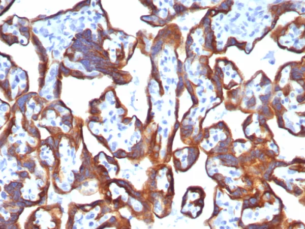 Recombinant Cytokeratin 7 (Glandular and Transitional Epithelial Marker) Antibody - Image 2