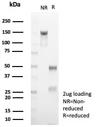 SDS-PAGE Analysis of Purified KRT10 Recombinant Mouse Monoclonal Antibody (rKRT10/6923). Confirmation of Purity and Integrity of Antibody.