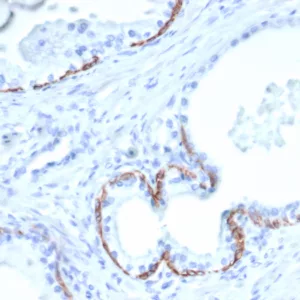 KRT14 Antibody in Immunohistochemistry (IHC (P))