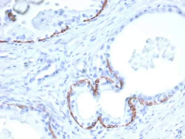 KRT14 Antibody in Immunohistochemistry (IHC (P))