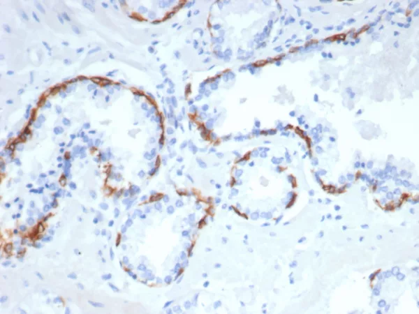 Recombinant Cytokeratin 14 (KRT14) (Squamous Cell Marker) Antibody