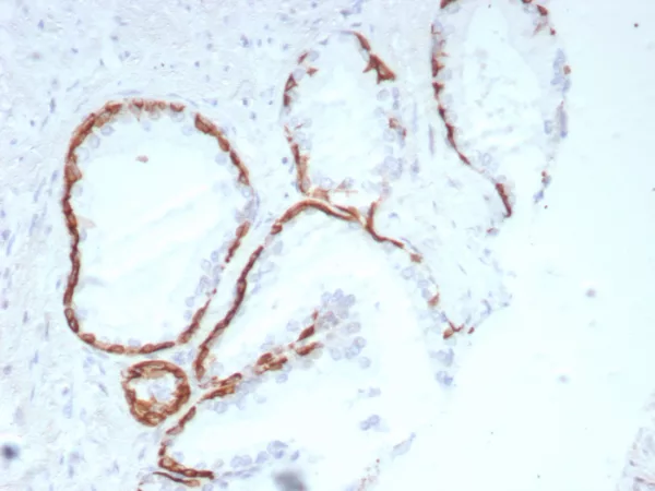 Recombinant Cytokeratin 14 (KRT14) (Squamous Cell Marker) Antibody