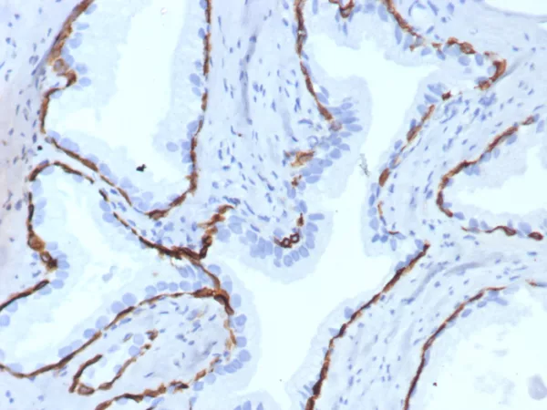 Recombinant Cytokeratin 14 (KRT14) (Squamous Cell Marker) Antibody