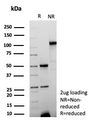 SDS-PAGE Analysis of Purified KRT15 Rabbit Recombinant Monoclonal Antibody (KRT15/9088R). Confirmation of Purity and Integrity of Antibody.