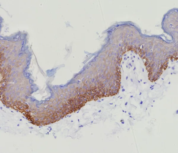 Formalin-fixed, paraffin-embedded human skin stained with  Cytokeratin 15 Rabbit Recombinant Monoclonal Antibody (KRT15/9088R). HIER: Tris/EDTA, pH9.0, 45min. 2°C: HRP-polymer, 30min. DAB, 5min.