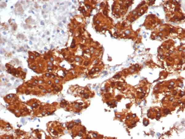 Interleukin-31 / IL-33 Antibody - Image 2