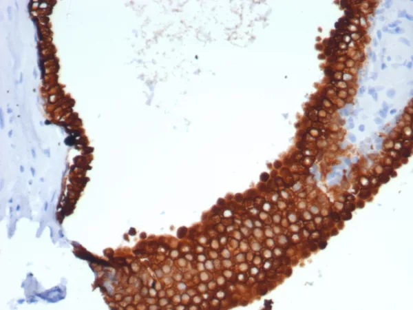 Recombinant Cytokeratin 18 (KRT18) Antibody