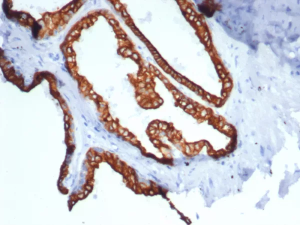 Recombinant Cytokeratin 18 (KRT18) Antibody - Image 2