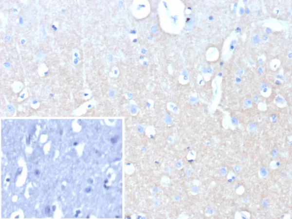 Formalin-fixed, paraffin-embedded human brain stained with CD171 Recombinant Rabbit Monoclonal Antibody (L1CAM/9146R). Inset: PBS instead of primary antibody; secondary only negative control.