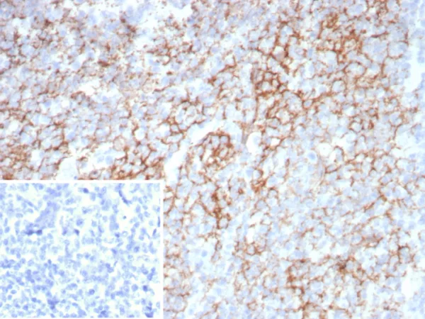 Lymphocyte Activation Gene 3 (LAG-3) (Negative Checkpoint Regulator) Antibody