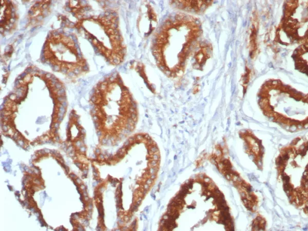 Formalin-fixed, paraffin-embedded human prostate stained with CD107a / LAMP1 Mouse Monoclonal Antibody (LAMP1/7456). HIER: Tris/EDTA, pH9.0, 45min. 2°C: HRP-polymer, 30min. DAB, 5min.