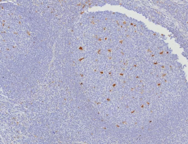 Formalin-fixed, paraffin-embedded human tonsil stained with CD107a / LAMP1 Mouse Monoclonal Antibody (LAMP1/7457). HIER: Tris/EDTA, pH9.0, 45min. 2°C: HRP-polymer, 30min. DAB, 5min.