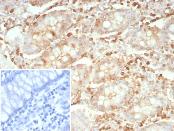 Recombinant Stathmin 1 / STMN1 Antibody