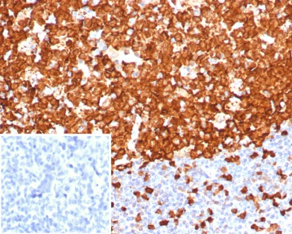 Formalin-fixed, paraffin-embedded human tonsil stained with Stathmin 1 Recombinant Rabbit Monoclonal Antibody (STMN1/8001R). Inset: PBS instead of primary antibody; secondary only negative control.