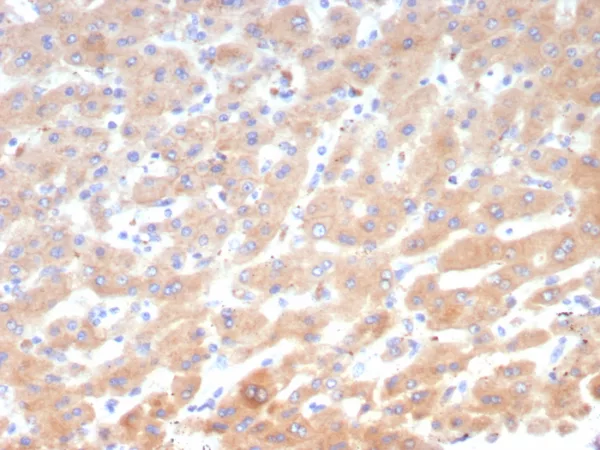 Leptin Receptor (LEPR) / Ob-R / CD295 Antibody