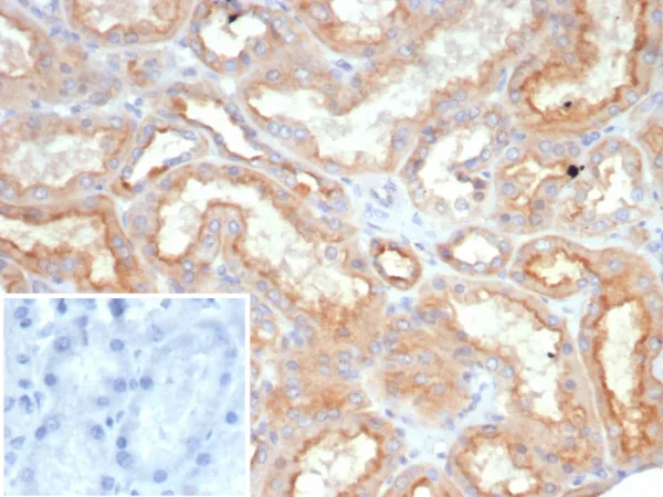 Leptin Receptor (LEPR) / Ob-R / CD295 Antibody - Image 2