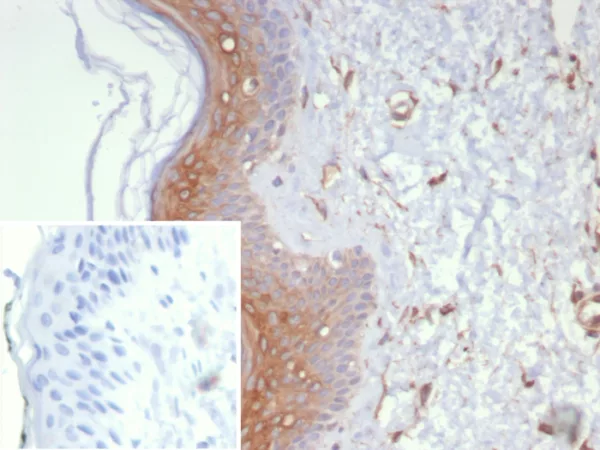 Formalin-fixed, paraffin-embedded human skin stained with Galectin-3 Mouse Monoclonal Antibody (LGALS3/6583). Inset: PBS instead of primary antibody; secondary only negative control.