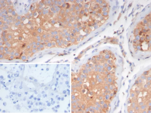 Luteinizing Hormone / Choriogonadotropin Receptor (LHCGR) Antibody