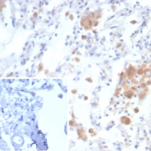 Formalin-fixed, paraffin-embedded human lung stained with CD91 / LRP1 Mouse Monoclonal Antibody (LRP1/6784) Inset: PBS instead of primary antibody; secondary only negative control.