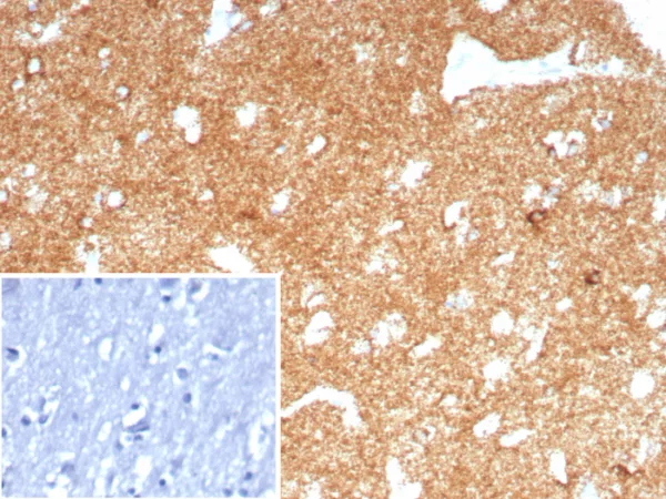 Formalin-fixed, paraffin-embedded human brain stained with CD91 / LRP1 Recombinant Rabbit Monoclonal Antibody (LRP1/8771R). Inset: PBS instead of primary antibody; secondary only negative control.