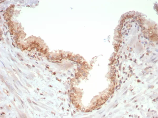 Formalin-fixed, paraffin-embedded human prostate stained with  SMAD4 Mouse Monoclonal Antibody (SMAD4/7903). HIER: Tris/EDTA, pH9.0, 45min. 2°C: HRP-polymer, 30min. DAB, 5min.