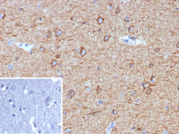 Formalin-fixed, paraffin-embedded human brain stained with MAP2 Mouse Monoclonal Antibody (MAP2/7673). Inset: PBS instead of primary antibody; secondary only negative control.
