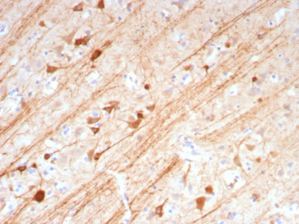Formalin-fixed, paraffin-embedded human brain stained with MAP2 Mouse Monoclonal Antibody (MAP2/7673). HIER: Tris/EDTA, pH9.0, 45min. 2°C: HRP-polymer, 30min. DAB, 5min.