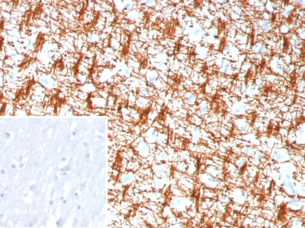Formalin-fixed, paraffin-embedded human brain stained with Myelin Basic Protein Recombinant Mouse Monoclonal Antibody (rMBP/9301). Inset: PBS instead of primary antibody; secondary only negative control.